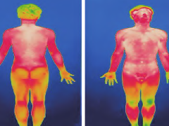 基于红外成像探究八段锦对脏腑经络调节作用